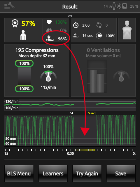 cprscoring_lowcompressionrfraction.jpg