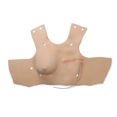 Mastectomi模块,oppgraderings洞穴