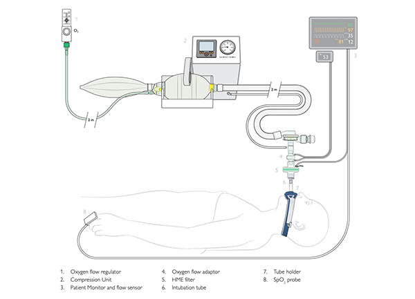 紧急Ventilator Illustration.png