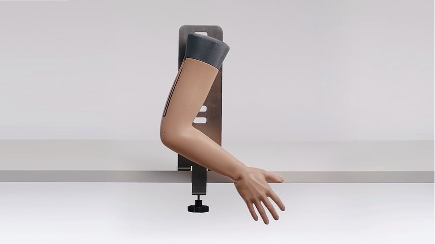 70250-colles-fracture-03.jpg 70250-colles-fracture-03.jpg