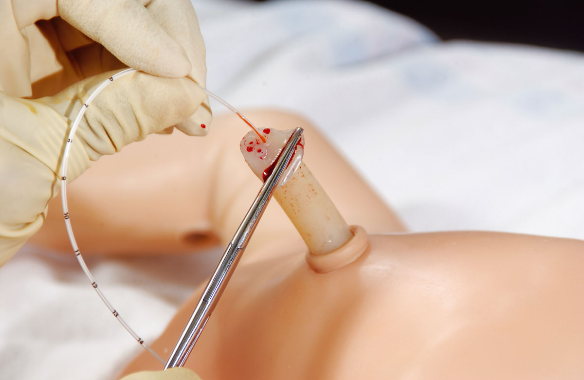 SimNewB_Umbilical.jpg